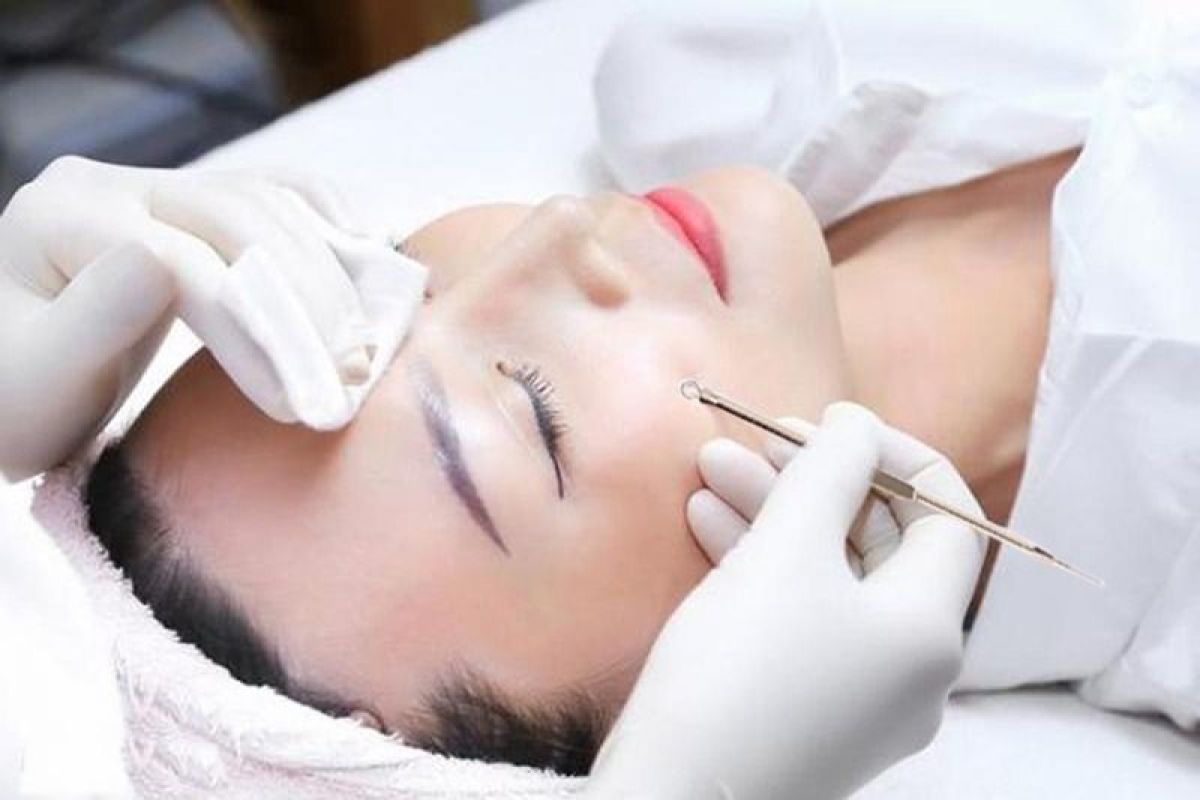Điều trị da mụn